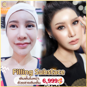 เติมเต็มร่องเเก้ม เสริมโหงวเฮ้ง