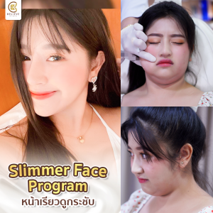 ฉีด meso fat ที่ไหนดี