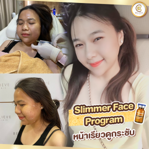 meso fat ลงจริงเห็นผล