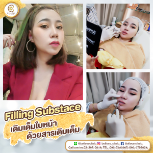 ฉีดฟิลเลอร์ ของแท้