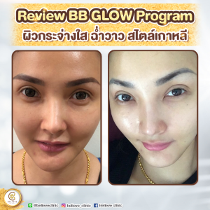 review BB Gold