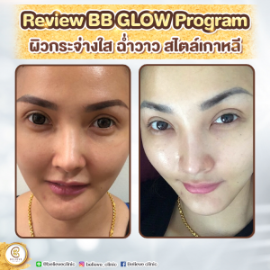 review BB Gold