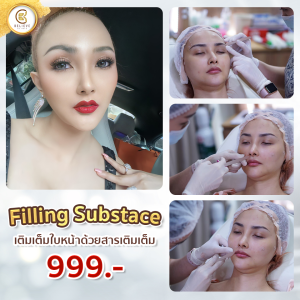 รีวิวฟิลเลอร์